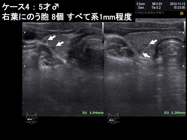 甲状腺図